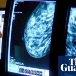 NHS to offer women in England drug that cuts recurrence of breast cancer